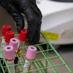Blood sample tubes with red and pink caps in a green rack