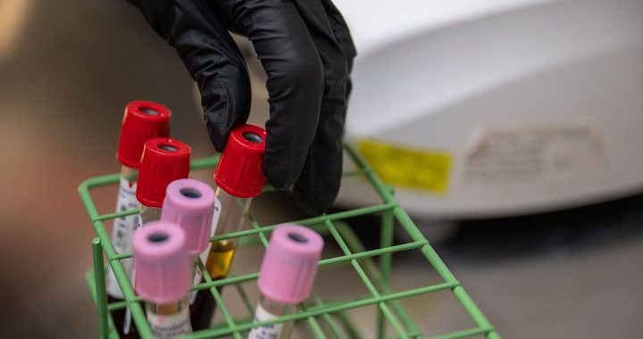 Blood sample tubes with red and pink caps in a green rack